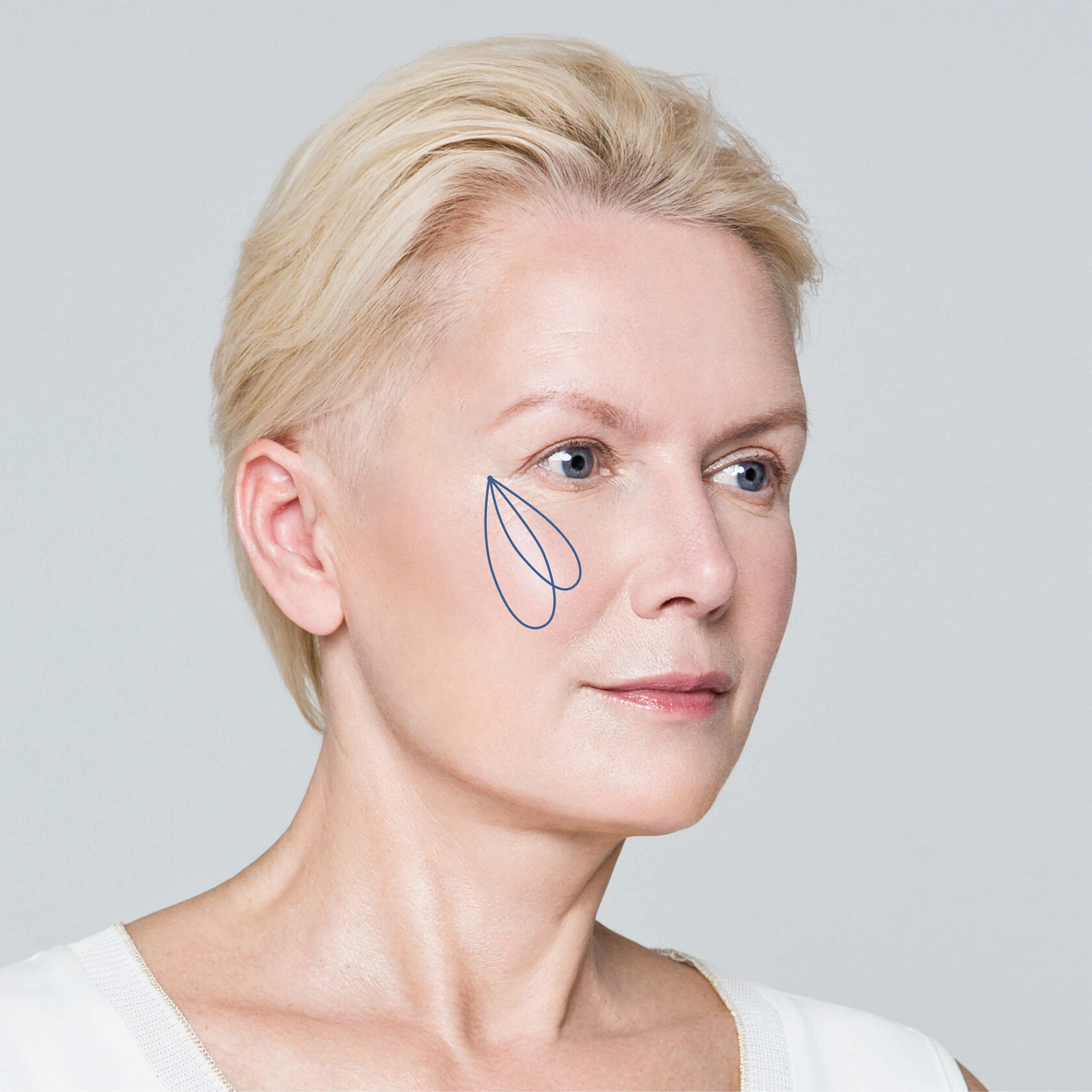Корекція недоліків